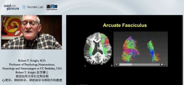 　　图注：Robert T.Knight 教授介绍患者案例展示对应的脑部影像结构