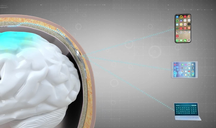 博睿康NEO微创植入脑机接口系统