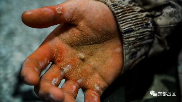 ▲周雄伟满是“勋章”的双手。