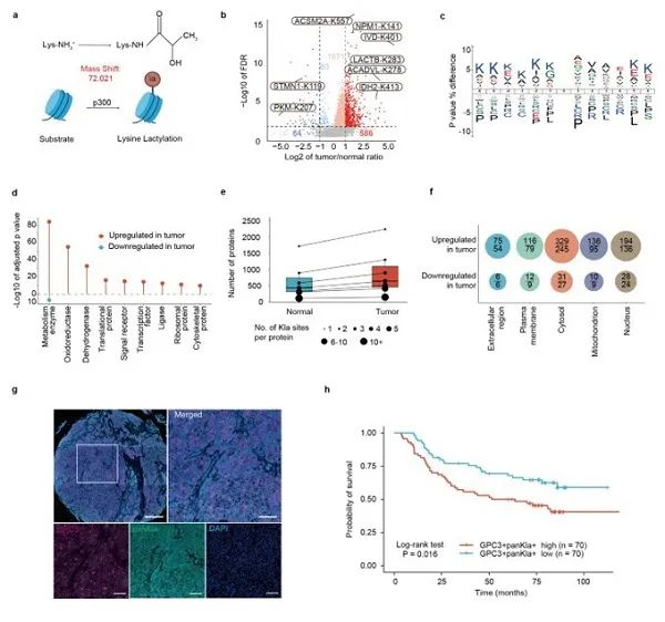 图1.肝细胞癌组织乳酸化图谱绘制