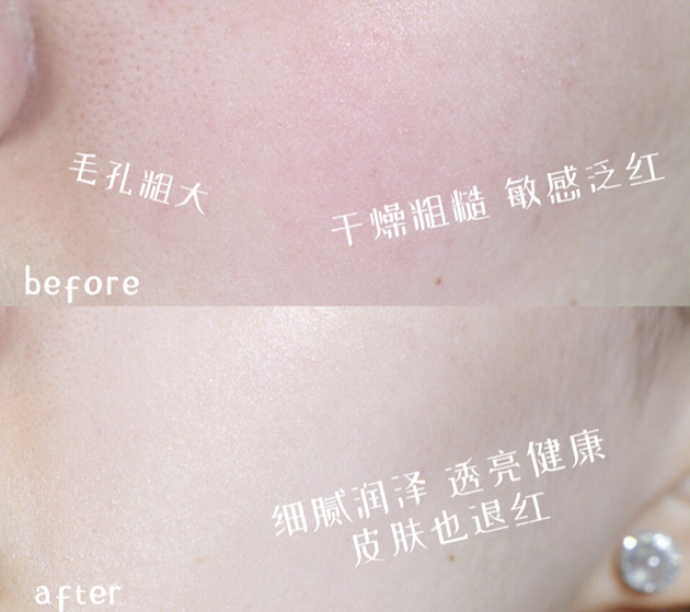 *使用效果因人而异