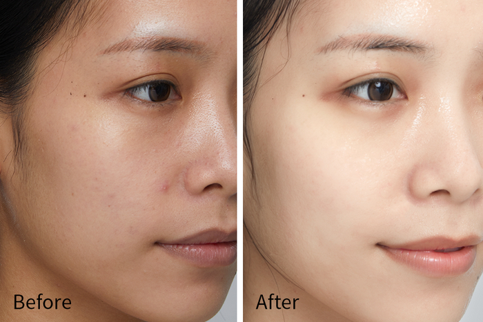 *使用效果因人而异