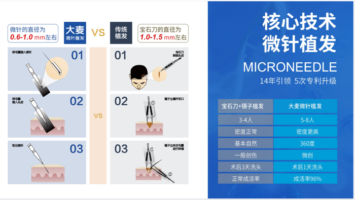 　　图:大麦微针植发与传统植发