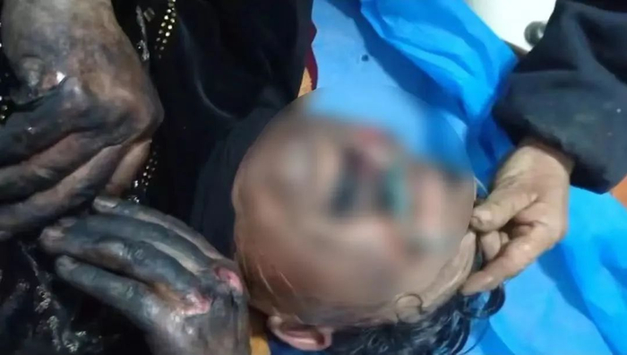 图为伤者被救出