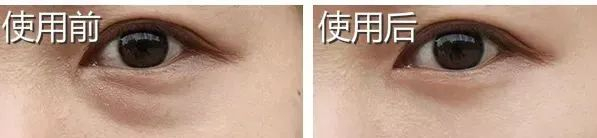 *使用效果因人而异