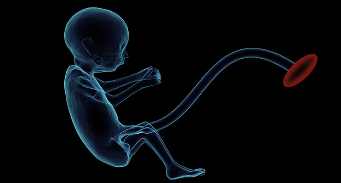 图片来源于Pixabay