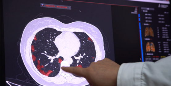 安亭镇社区卫生服务中心技师在根据AI辅助系统判断患者病情。