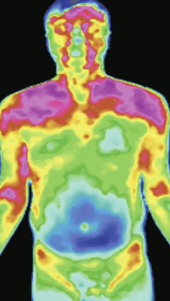 △患者上焦明显热偏离，下焦凉偏离，提示上热下寒体质