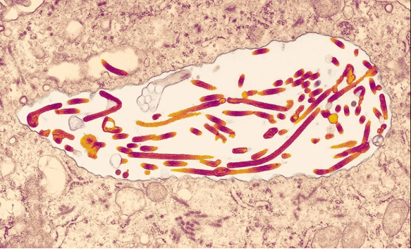 感染组织中的马尔堡病毒颗粒该病毒引起一种以出血热为特征的致命疾病