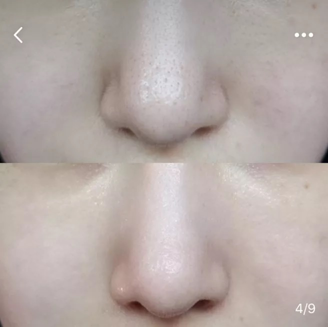 图片来源于小*书