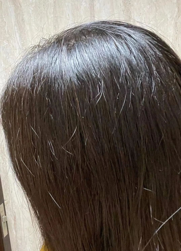 ▲实拍坚持了三天没洗的头发