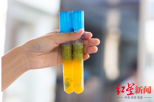 ↑实验室培养的免疫细胞 据图虫创意