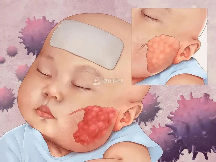 图源：腾讯医典