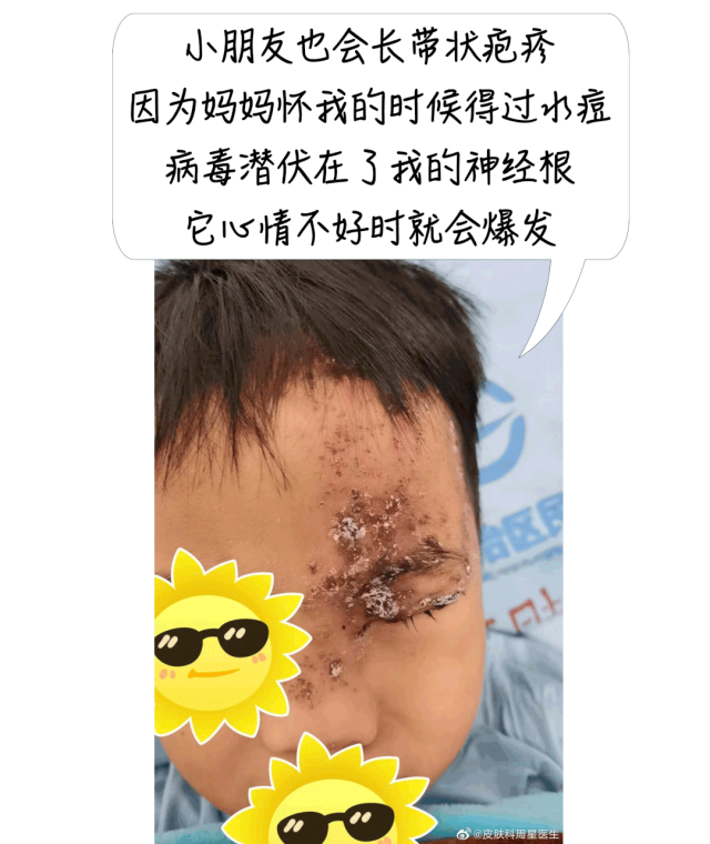 图源：@皮肤科周星医生