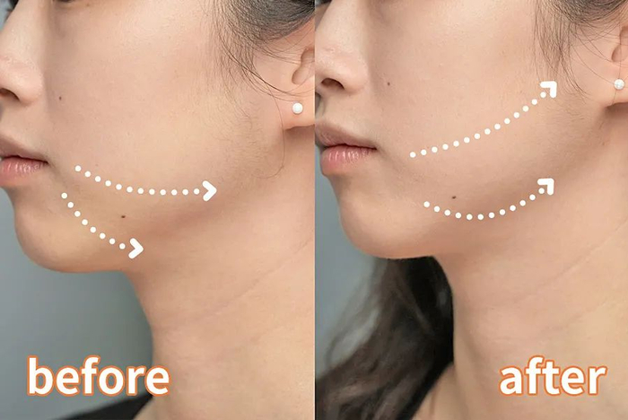 自己拍的，小姐姐说比喝咖啡消肿要快些