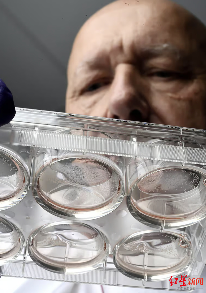 ↑托马斯·哈东拿着一组装有“类器官”的培养皿