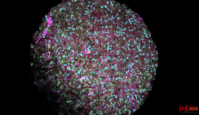 ↑脑“类器官”细胞染色图片