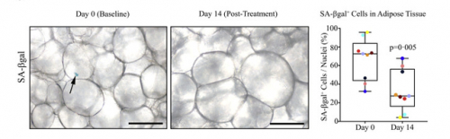 　　图2人体脂肪组织衰老细胞数量减少了60%以上