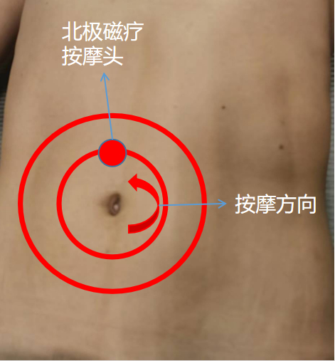 （△ 捏脊、按腹示意图）
