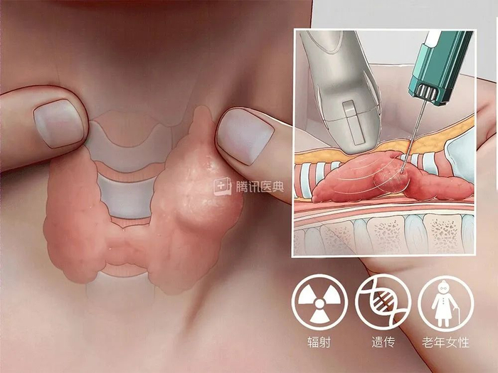 ▲图源：腾讯医典
