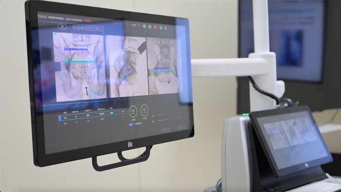 骨科机器人相关设备 图片来源：每经记者 韩阳 摄