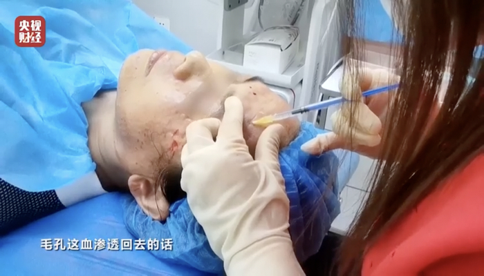 顾客现场被注射化妆品