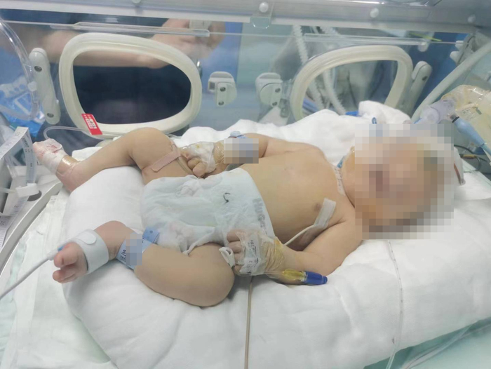 ▲孩子手术后