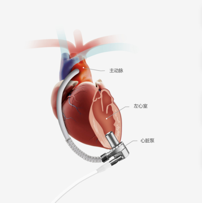 图源：核心医疗官网