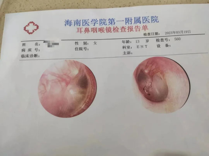 林某的检查报告单。图/受访者提供