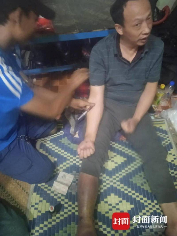 幸卫林逃跑后接受简单治疗（受访者供图）