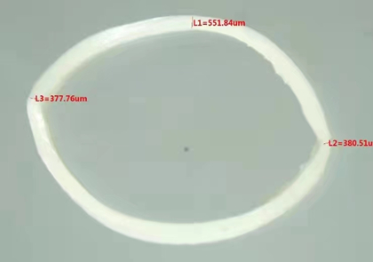 图5 缝合效果显微观察图片