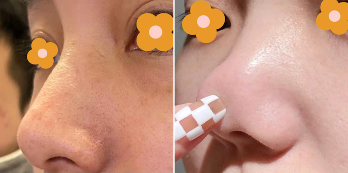 图源真实用户，仅供参考，实际效果因人而异