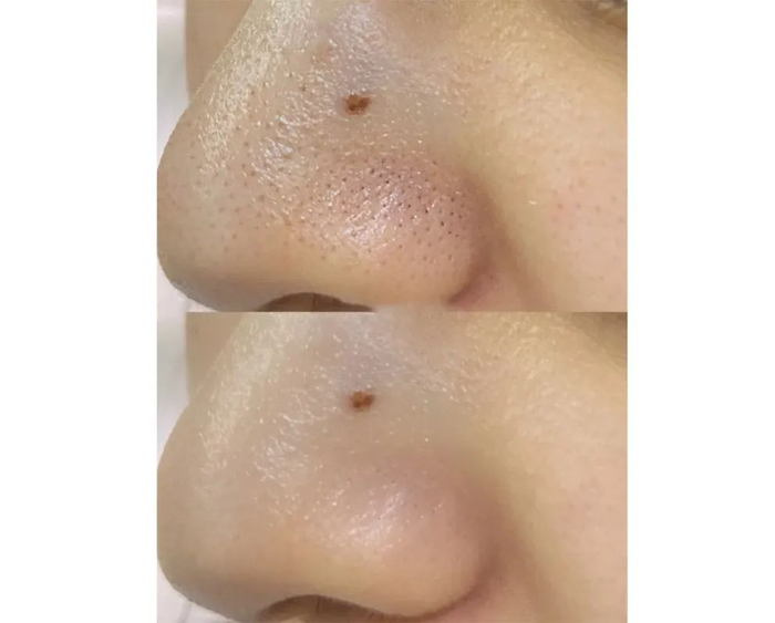 图源真实用户，仅供参考，实际效果因人而异