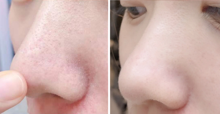 图源真实用户，仅供参考，实际效果因人而异