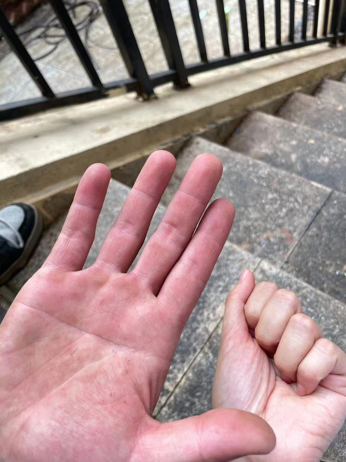 因为打理民宿而变糙的手掌，桃子专门拍照留念 图片由受访者提供