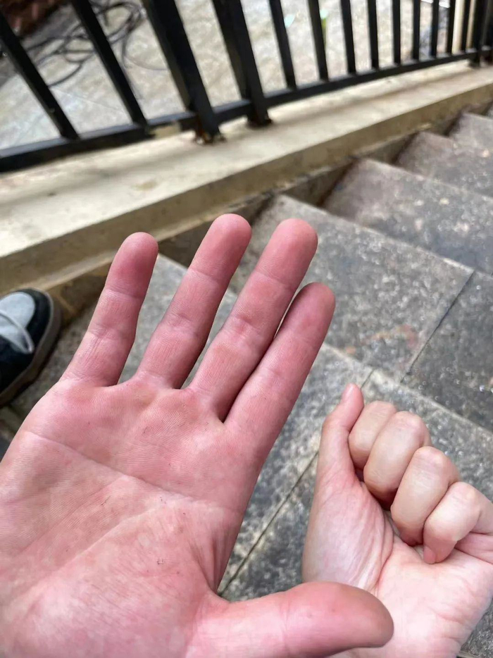 △ 因为打理民宿而变糙的手掌，桃子专门拍照留念 图片由受访者提供