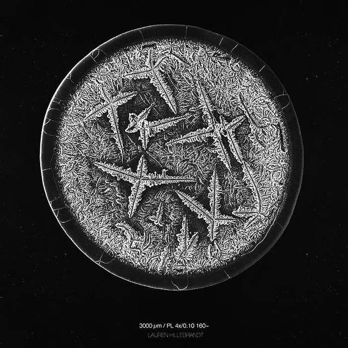     悲伤时流下的眼泪