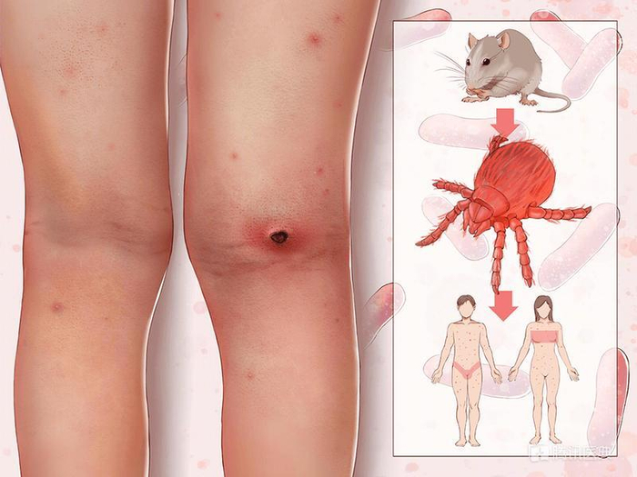 图片来源：腾讯医典