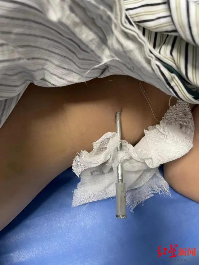 ↑地钉扎进男孩的腰部