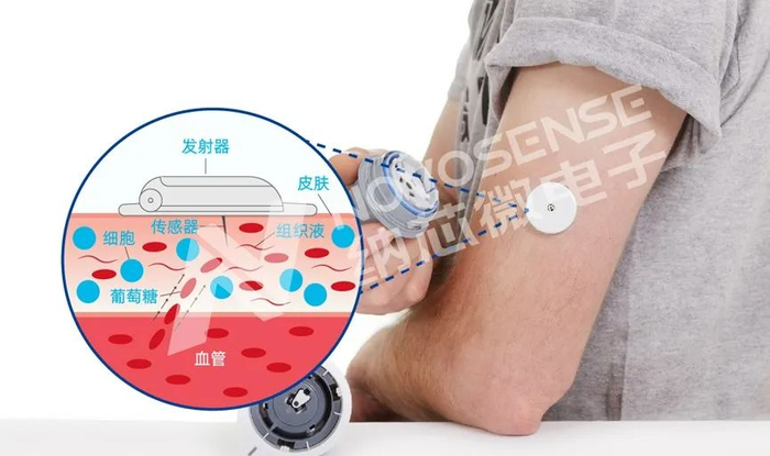 图：CGM血糖监测