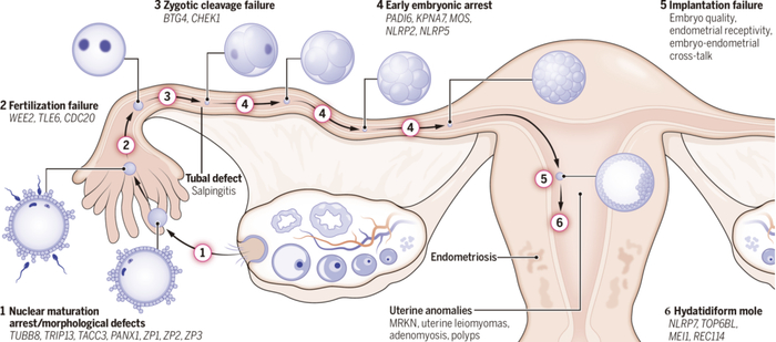 图2 不同类型卵子、受精及胚胎发育异常及致病基因