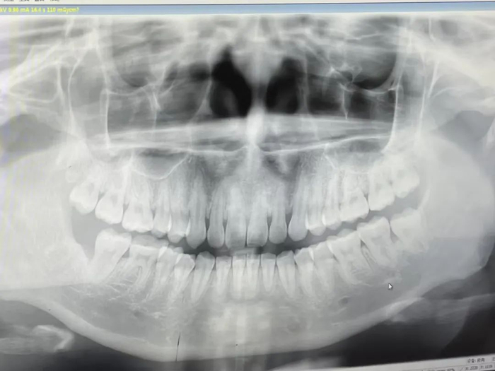 图片来源：自己拍的