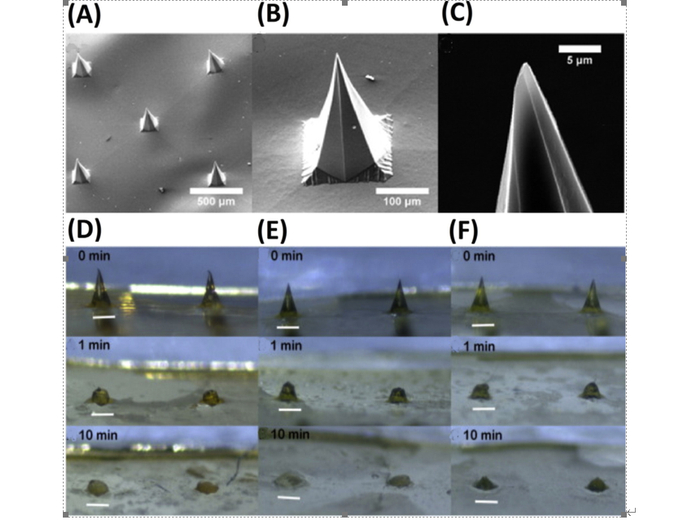 图2微流控芯片微针透皮给药