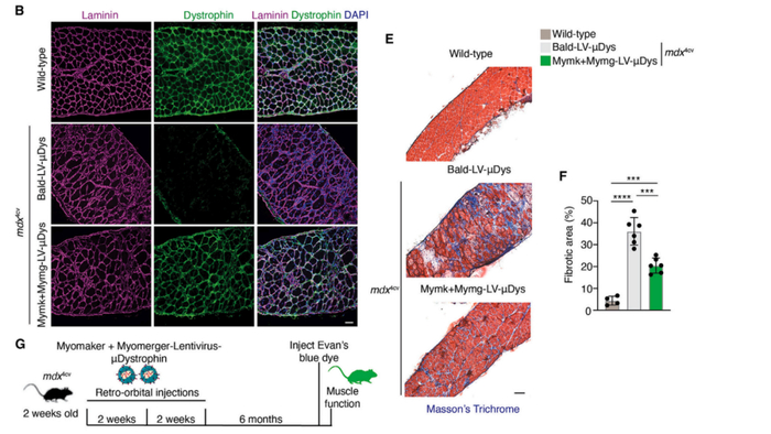 Mymk-Mymg包膜病毒载体将μDystrophin基因靶向到骨骼肌细胞中，改善DMD小鼠的病理情况
