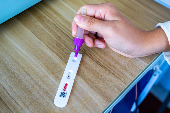 ↑抗原试剂检测。图据IC photo