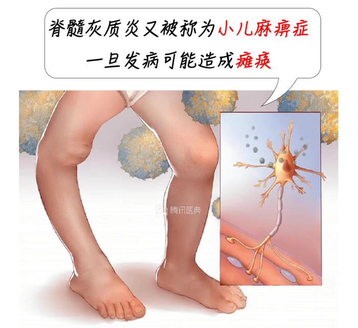 ▲图源：腾讯医典