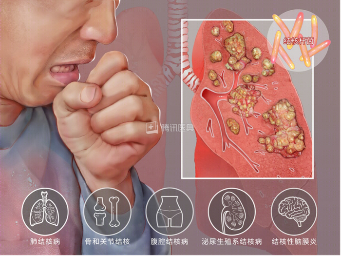 ▲图源：腾讯医典