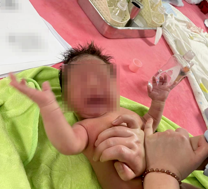 ↑宜阳县中医院护士给孩子做“排气操”按摩  受访者供图