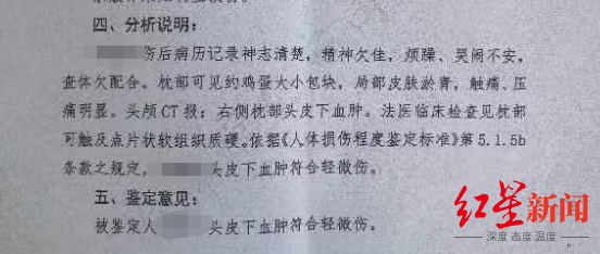 ↑鉴定结果显示，小晨头皮下血肿符合轻微伤 受访者供图