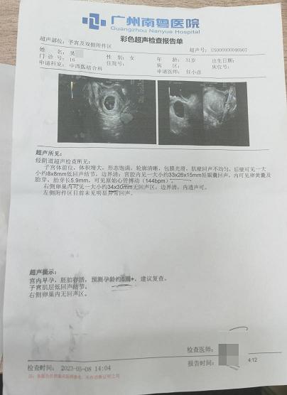 输卵管报告单图片图片